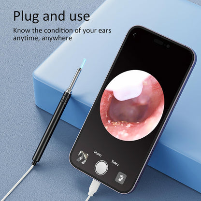 Otoscope with Light for iPhone iPad - Ultra Clear View Ear Scope Otoscope with Light | 3.5mm Otoscope Camera with Ear Wax Removal Tools | Ear Otoscope Supports Photo Capture & Video Recording